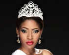 Top Nigerian model dies of skin infection