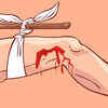 Applying tourniquet even if there is no arterial bleeding