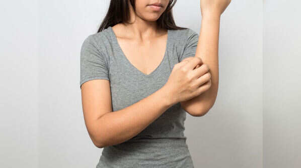 Itchy skin