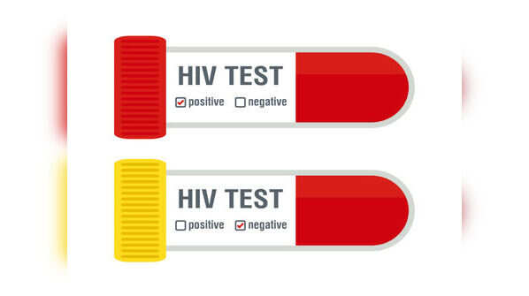 The second stage of HIV