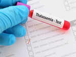 Thalassemia Test