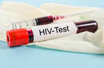 HIV and STDs