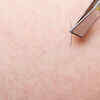 ​Risk of ingrown hair