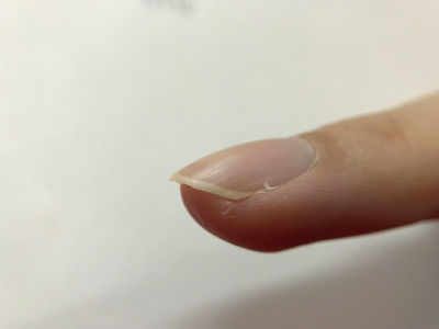 Why you should never rip off your hangnail | The Times of India