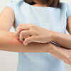 It may cause skin allergy and rashes