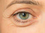 ​Treat baggy eyes and remove puffiness