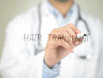 ​Must know facts about hair transplant: