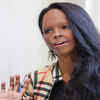 Article image for: Acid attack survivor's story: 'Mostly it is the women who bully'