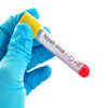 NiV may also be present in the infected person's urine