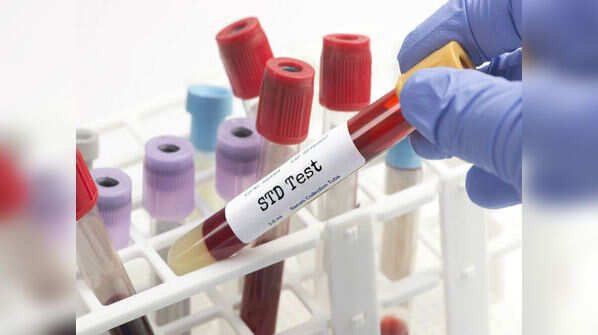  STD screenings