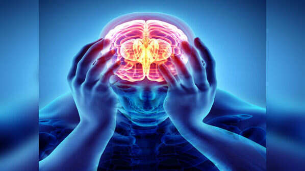 Migraine headaches