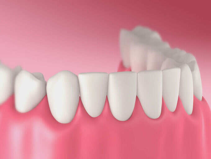 Warning Receding Gums Can Affect Your Teeth The Times Of India