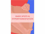 Dark spots and hyperpigmentation