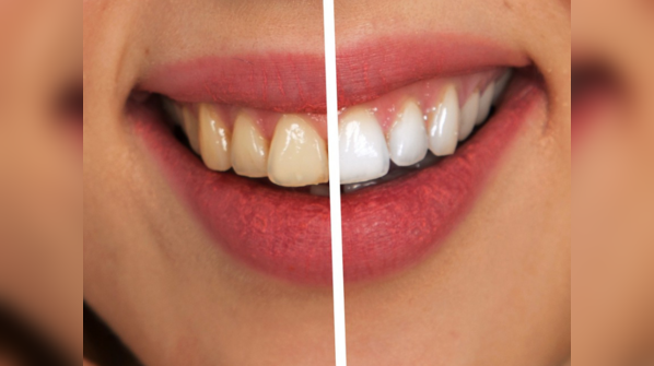 Dental issues