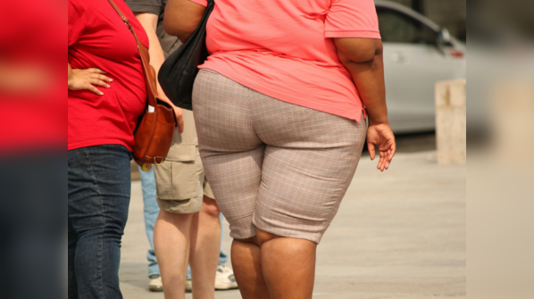 Obesity