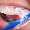 ​How to get rid of bad breath?