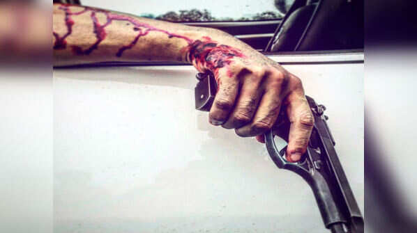 Ankush gets bloody!