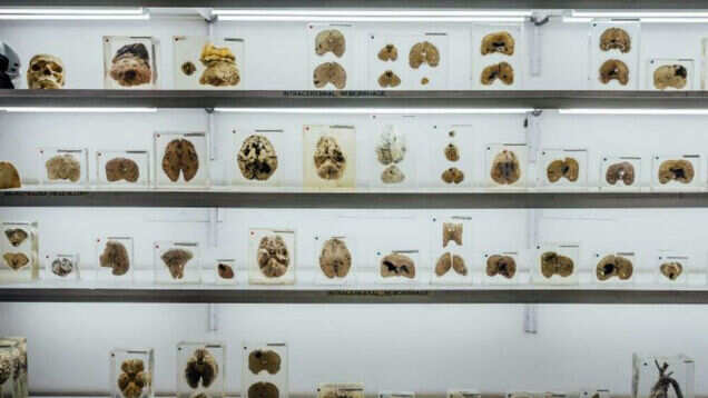 Visit India&rsquo;s first ever brain museum that is demystifying the grey matter