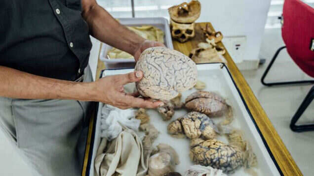 Visit India&rsquo;s first ever brain museum that is demystifying the grey matter