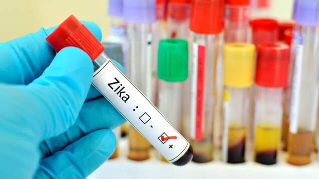 Travel advisory&mdash;Jaipur on alert as Zika Virus hits it
