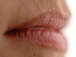 Cuts on the inner corners of your lips