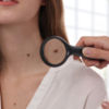 ​New moles