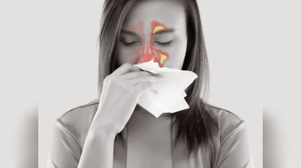 What causes sinus?
