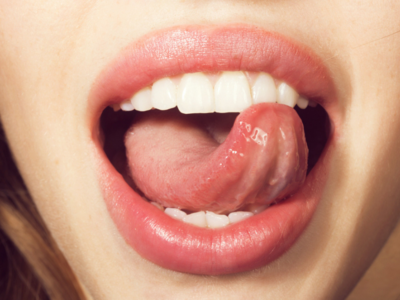 healthy tongue underside