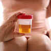 Urine acne buster