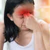 ​Headache