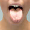 Antifungal