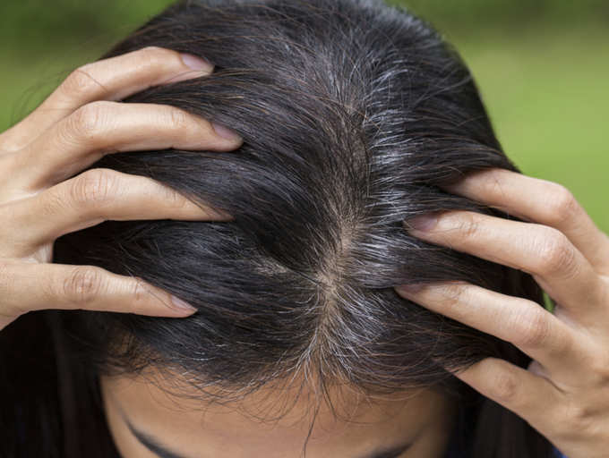 Grey hair at 30? Home remedies to REVERSE the problem | Home Remedy to Get  Rid of Grey Hair