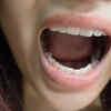 Natural mouth freshener