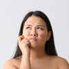 ​Fight acne