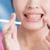 Causes of yellow teeth