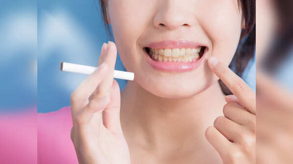 Causes of yellow teeth