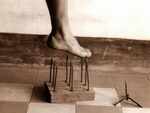 Pain insensitivity