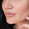 ​Problem: Your skin is dehydrated