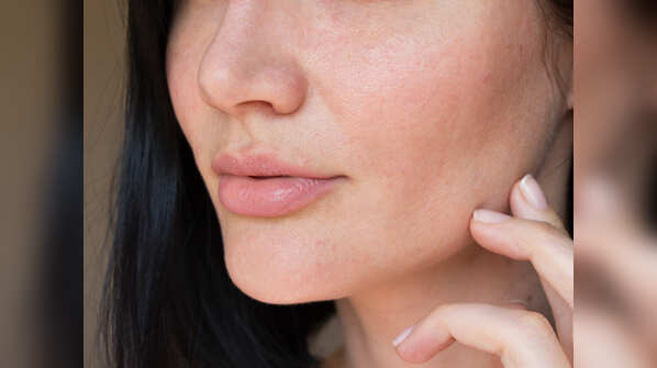 Problem: Your skin is dehydrated