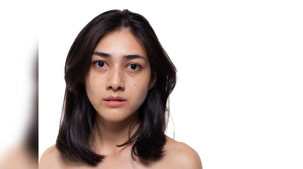 Problem: Dead skin cells