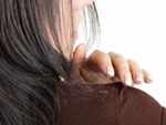 Facts about dandruff