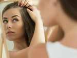 Here's how to treat hair loss at the temples