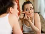 Popping zits