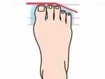 The Roman Toe