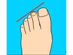 The Egyptian Toe