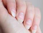 White or red spots under your nails