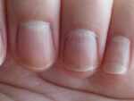 Pale nails