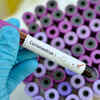 ​Myth number 9: A cure for novel coronavirus has been found