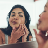 The dreaded acne
