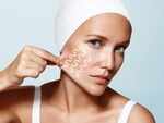 Want to tighten your skin? These home remedies will help